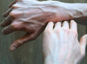 Why are your veins suddenly bulging and visible?