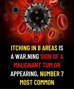 Itching in 8 Areas: A War.ning Sign of Malignant Tum.ors, Number 7 Is the Most Common