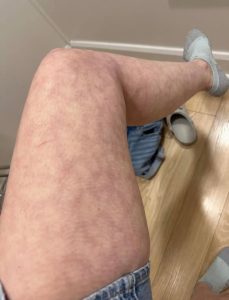 These are the consequences of sleeping with…See more