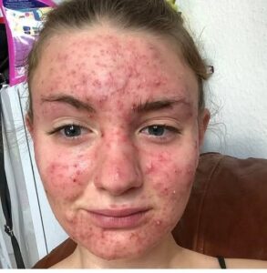 His body was itchy, he thought it was an allergy