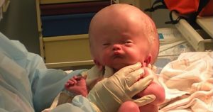 Grab a tissue before you read about Little Parker’s miracle story