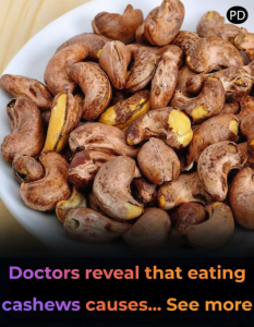 Doctors reveal that eating cashews causes