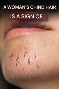 Why Chin Hair Grows in Women and What It May Indicate
