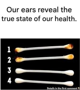 The Silent Diagnostic: What Your Earwax Reveals About Your Internal Health