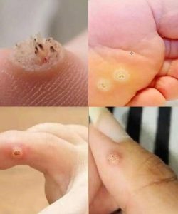 BE VERY CAREFUL . If you get this, you are infected with …. See more